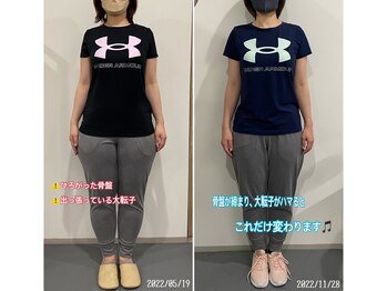 ナナ 大塚店(NANA)/BeforeAfter