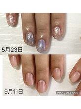 リリー(Lilly)/ジェルで爪育成