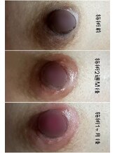 ツボミ(tubomi)/ローマピンク｜バストトップ…２