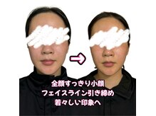 ヨサパーク リリア 立川北口店(YOSA PARK Lylia)の雰囲気(酸素×水素のW吸入プラス!脂肪燃焼&エイジングケアが叶う◎)