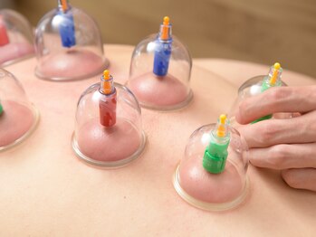 ほぐし健康整体院/カッピング