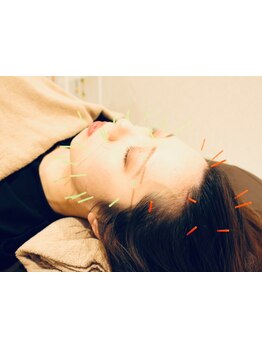 鍼灸施術を受けたい