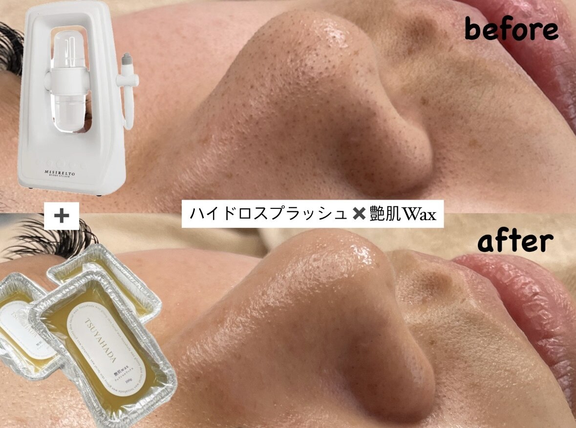 サロン ド ヴィヴィ(salon de vivi)｜ホットペッパービューティー