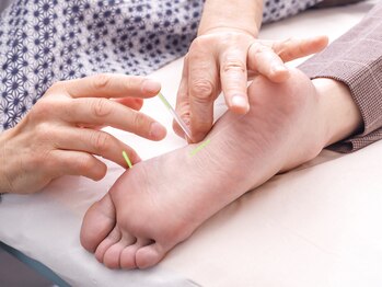 鍼灸マッサージ治療院 巡気堂/≪首・肩こり鍼灸¥4,000≫