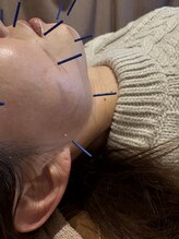 ほりうちケア鍼灸院整骨院/