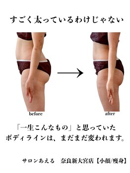 サロンあえる 新大宮店/すごく太っているわけじゃない