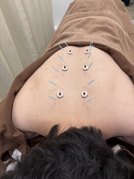 高座渋谷駅鍼灸院 整骨院/鍼灸/大和市/高座渋谷/肩こり