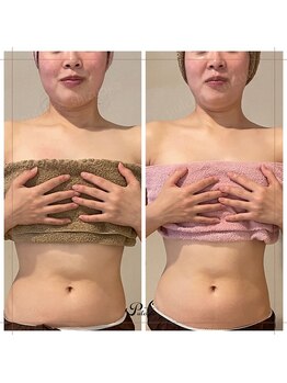 プルクレ 常磐町店(Pulchre)/ビフォーアフター♪