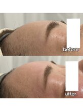 リリー(Lily)/フェイスWAX