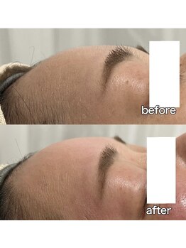 リリー(Lily)/フェイスWAX