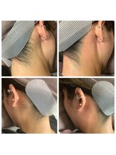 ルル(RuRu)/ Wax脱毛