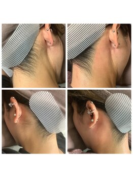 ルル(RuRu)/ Wax脱毛