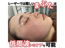 エステの森ジュジュの雰囲気(【断トツ人気No.1】目の周り・瞼の上・細部までシミケア可能◎)