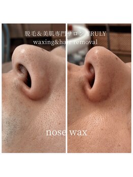 トゥルーリー(TRULY)/《鼻毛ワックス》