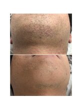 エリクサー 太田店(Elixir)/before after