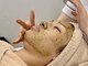 ラシュール(Rassure)の写真/毛穴の開き・黒ずみ・ザラつきにはダウンタイム無しハーブピーリングで徹底改善！ファンデが綺麗に乗る肌へ
