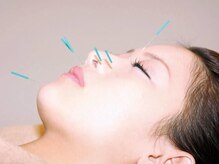 ほりうちケア鍼灸院整骨院/