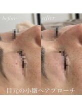 ビューティーサロン プティ(beauty salon petite)/エイジングケア大曽根/森下/徳川