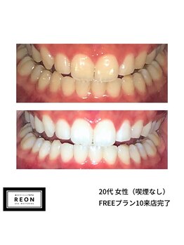 レオン 磐田(REON)/◇ お客様 before＆after ◇