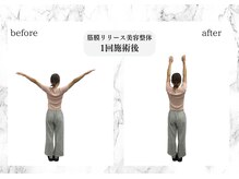 トキ(TOKI)/筋膜リリース美容整体　施術直後