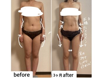 つばききよら/‐10キロ激やせビフォーアフター