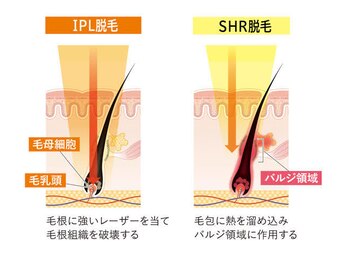 ワイズサロン(Y's salon)/『SHR』、『IPL』両モード搭載