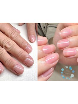 爪の悩みを解消できる（ケア含む）