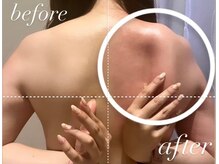 エムフルール 吹田市/肩甲骨の変化に注目