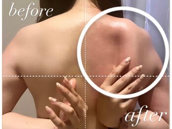 エムフルール 吹田市/肩甲骨の変化に注目