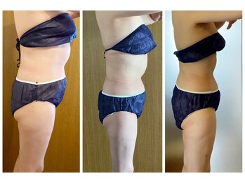 アリス 赤坂の写真/更年期太りにお悩みの女性も段階を踏みながら土台作り→バランス良く整えていく