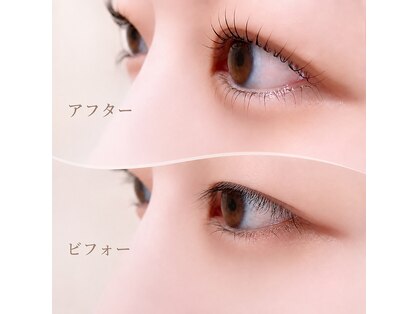 ビューティーサロン ユリン(YuRin)の写真