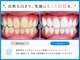 ココホワイトニング(coco whitening)の写真