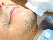 ルラ 大宮店(Lula)/メンズのひげも