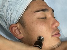 韓美 表参道店(HANMI)/幹細胞導入(イオンザイム)