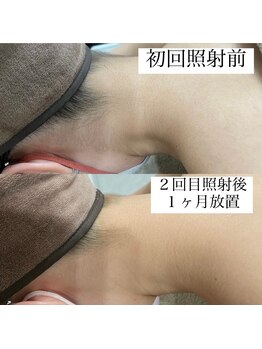 テンパ ビューティー(+10%beauty)/効果写真