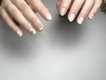 アテ(ate.)/定額シンプル