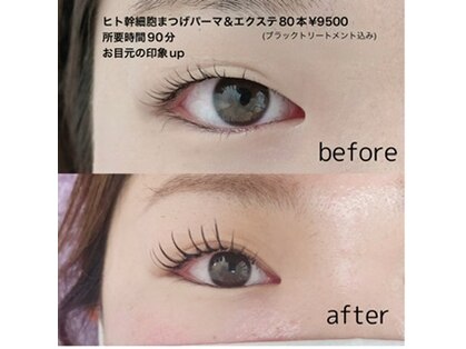 ノヘアン(noheanc)の写真