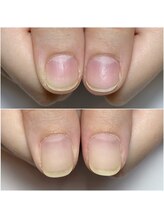 サロン アンド ルクス(Salon & Lux)/自爪育成