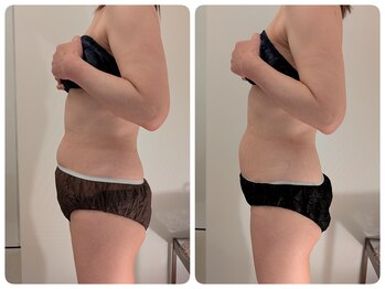 ワイズ(Y's)/お腹7回目