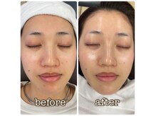 ブリス(BLISS)の雰囲気（シェービングでお顔の産毛・角質を除去してお化粧のり抜群◎）