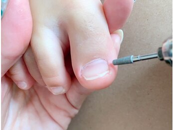 プラスジャム(Plus Jam)の写真/【お悩み解消！喜びの声多数】足爪も手爪も,理想の健康で美しい爪に！(巻き爪/深爪/自爪育成/爪質改善…)♪
