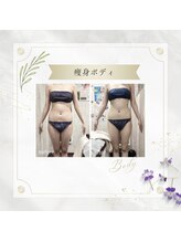 アディッシモ(addissimo)/セルマシーンで頑固な脂肪を分解