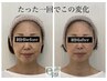 効果No.1《先着5名》全て整う★小顔矯正プレミアムフルコース ¥20,900→¥8800
