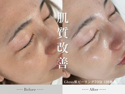 ミーティスの写真