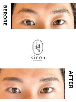 キノン(kinon)の写真/眉が変わると印象が変わる♪垢抜け眉へ