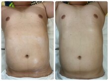 ゴールドプラス 伊勢店(GOLD PLUS)/BeforeAfter