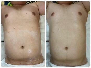 ゴールドプラス 伊勢店(GOLD PLUS)/BeforeAfter