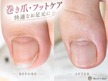 ニコワイズネイル(Nico Y's Nail)の雰囲気（巻き爪ケアもお任せ下さい！平均1～3回で改善！）