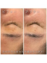 ヴィオナス(Veonus)/肌のハリ不足にも効果