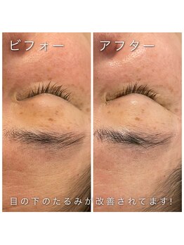 ヴィオナス(Veonus)/肌のハリ不足にも効果